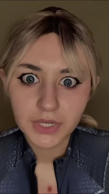 mimidoescosplay - hey guys im sorry for not posting for a little i have an ear