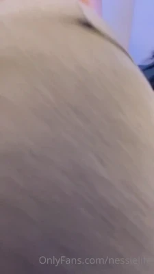 nessielife - Giant bruise on my ass from when I fell at gov ball after getting